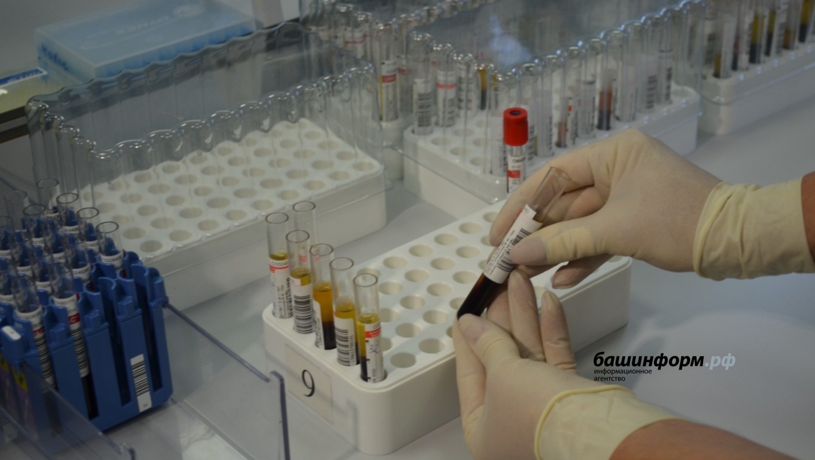 В Башкирии медико-генетический центр будет проводить расширенный неонатальный скрининг